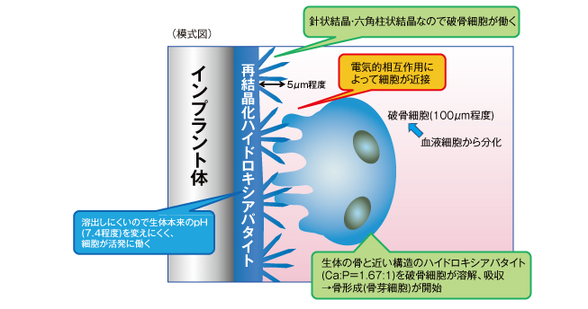 メカニズム