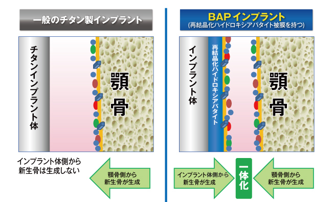 比較概略図