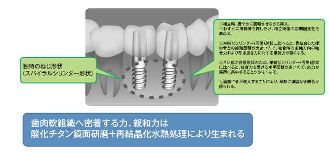 スパイラルシリンダー形状