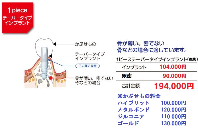 1ピースTタイプインプラント料金