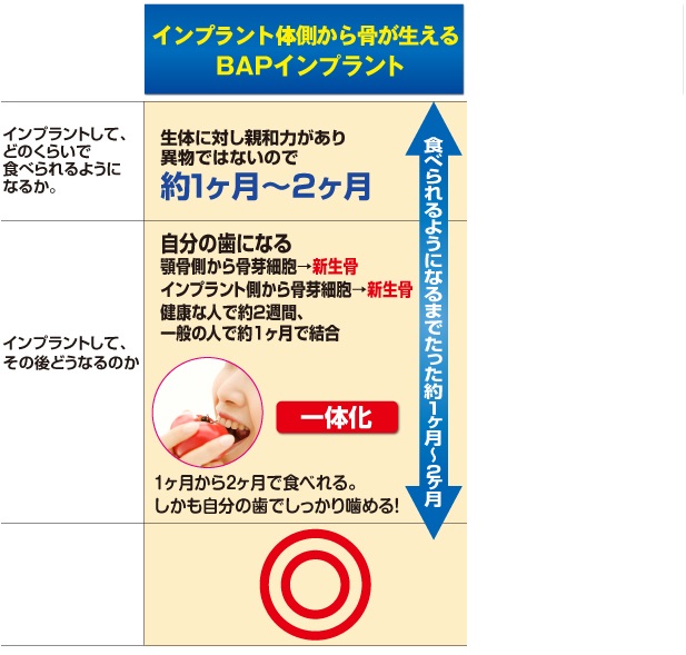 BAPインプラント