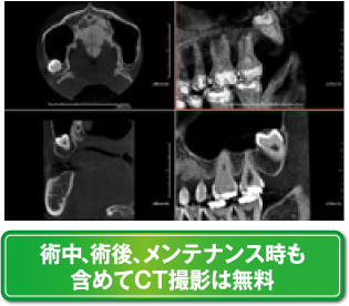 CT画像